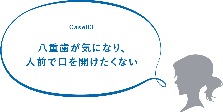 Case03 八重歯が気になり、人前で口を開けたくない